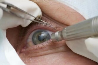 cirurgia-que-altera-cor-do-olho-tem-uso-restrito-para-pessoas-cegas