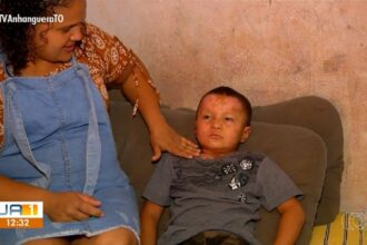 menino-de-cinco-anos-atingido-por-explosao-de-churrasqueira-recebe-alta:-nasceu-de-novo,-diz-mae